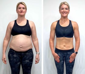 Lipovive-user-testimonial1